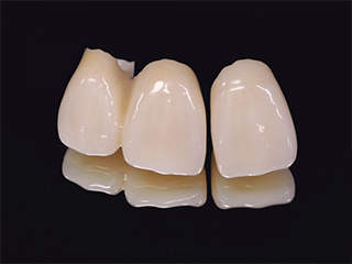 審美歯科のイメージ画像